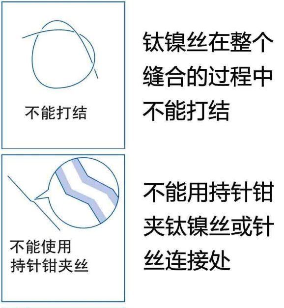 【兆恒機(jī)械】鈦鎳記憶合金組織吻合器使用注意事項